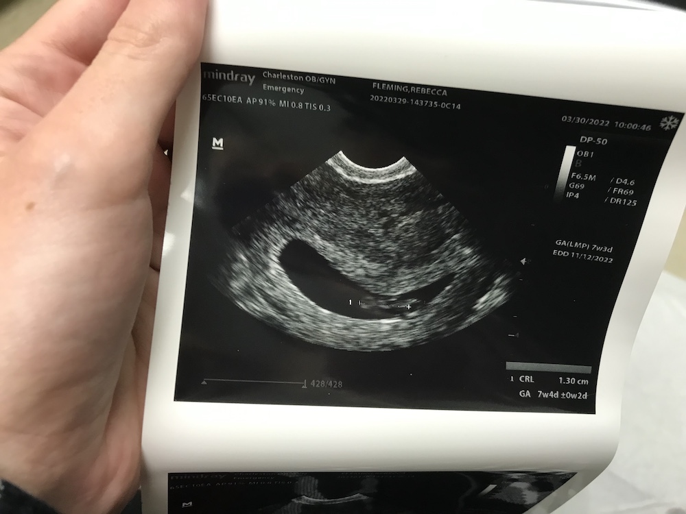 RenderedImage Tiny baby Millie, 7 weeks along.